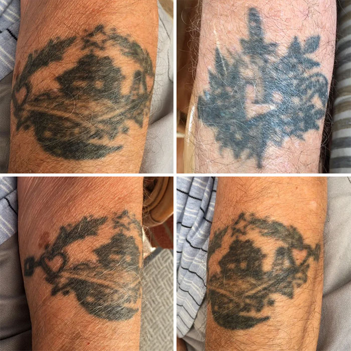 aging tattoos after 50 years